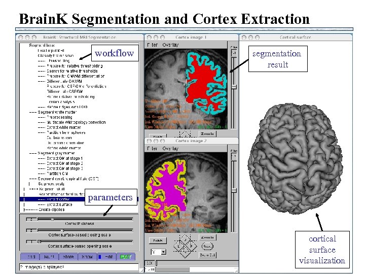 Brain. K Segmentation and Cortex Extraction workflow segmentation result parameters cortical surface visualization 