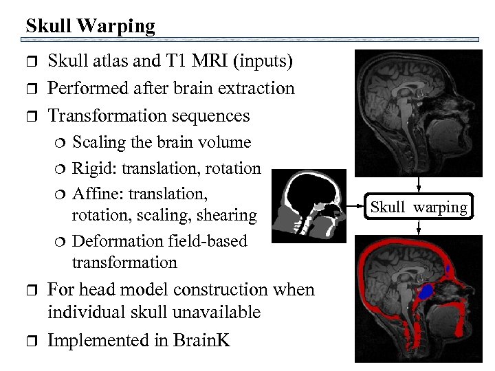 Skull Warping r r r Skull atlas and T 1 MRI (inputs) Performed after