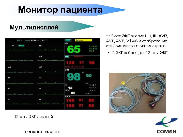 Монитор пациента Мультидисплей • 12 -отв. ЭКГ анализ I, III, AVR, AVL, AVF, V