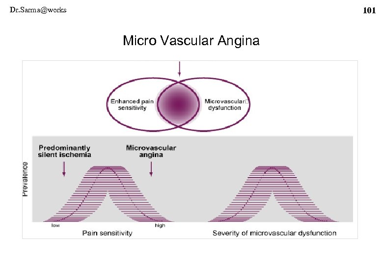 Dr. Sarma@works 101 Micro Vascular Angina 