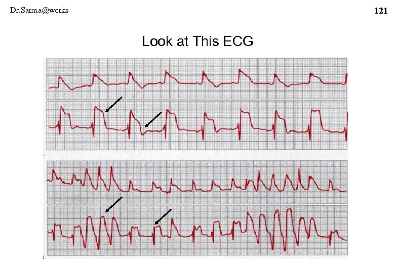 Dr. Sarma@works 121 Look at This ECG 
