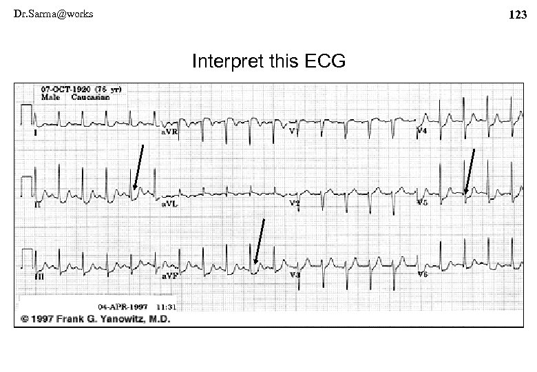 Dr. Sarma@works 123 Interpret this ECG 