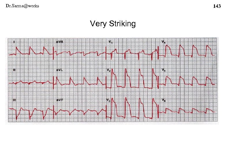 Dr. Sarma@works 143 Very Striking 