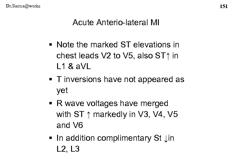 Dr. Sarma@works 151 Acute Anterio-lateral MI § Note the marked ST elevations in chest