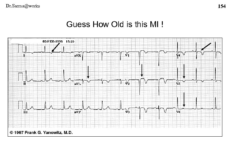 Dr. Sarma@works 154 Guess How Old is this MI ! 