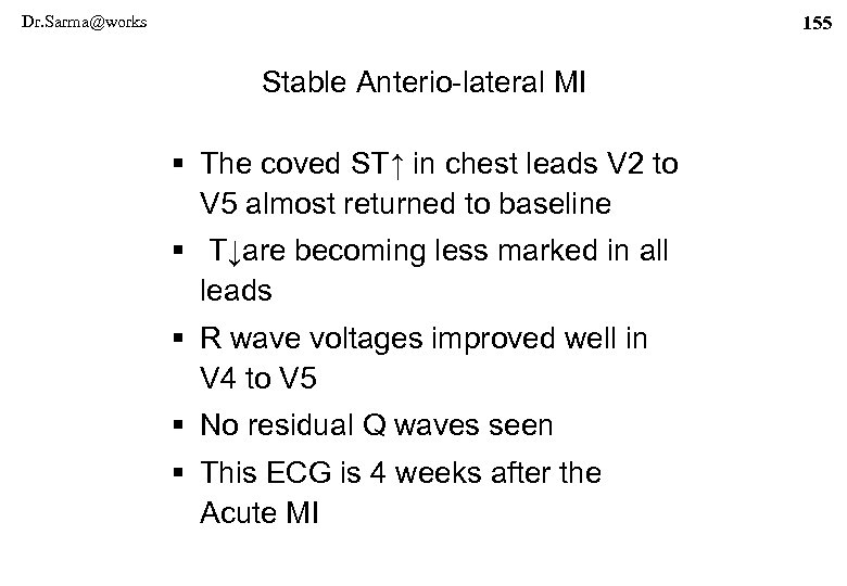 Dr. Sarma@works 155 Stable Anterio-lateral MI § The coved ST↑ in chest leads V
