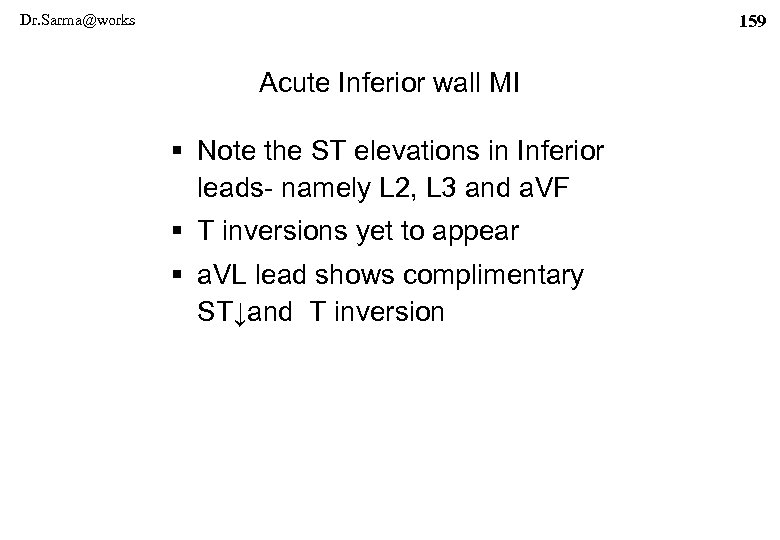 Dr. Sarma@works 159 Acute Inferior wall MI § Note the ST elevations in Inferior