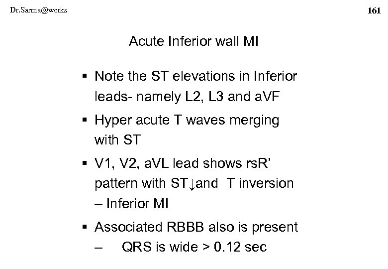 Dr. Sarma@works 161 Acute Inferior wall MI § Note the ST elevations in Inferior