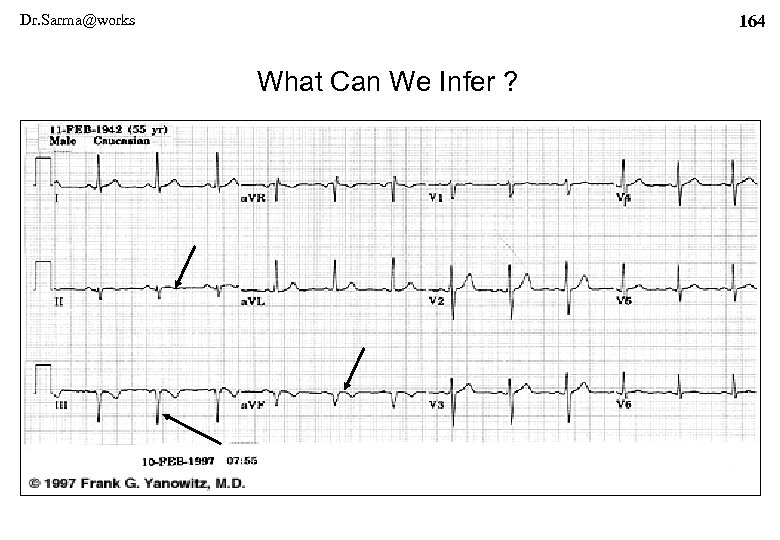 Dr. Sarma@works 164 What Can We Infer ? 