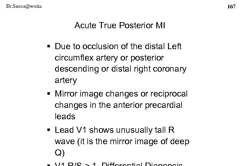 Dr. Sarma@works 167 Acute True Posterior MI § Due to occlusion of the distal