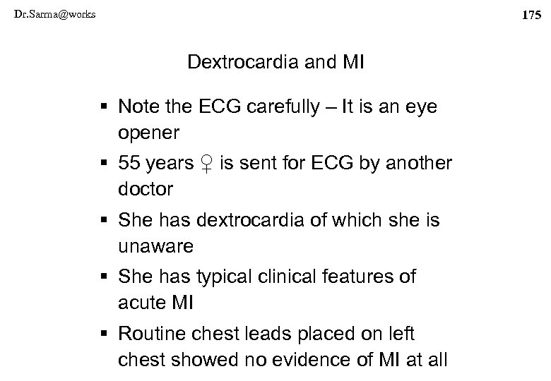 Dr. Sarma@works 175 Dextrocardia and MI § Note the ECG carefully – It is