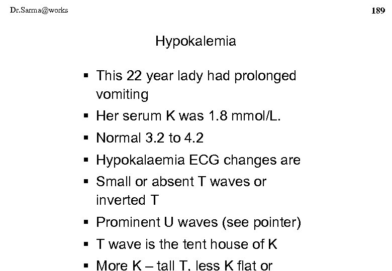 Dr. Sarma@works 189 Hypokalemia § This 22 year lady had prolonged vomiting § Her