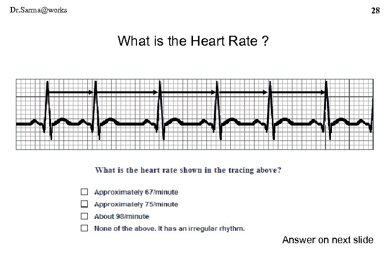 Dr. Sarma@works 28 What is the Heart Rate ? Answer on next slide 