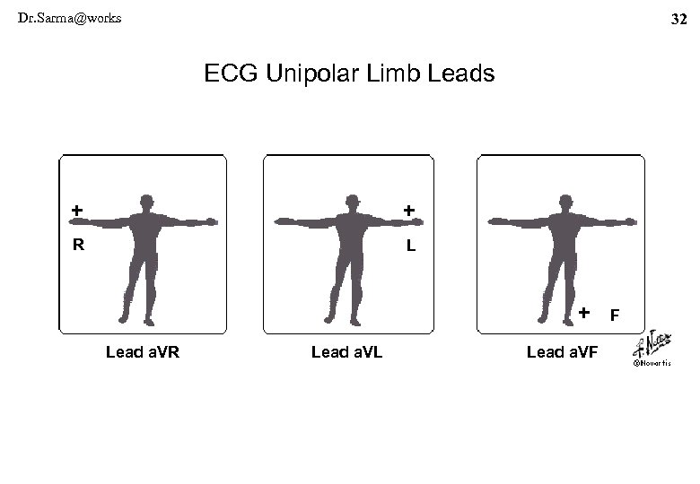 Dr. Sarma@works 32 ECG Unipolar Limb Leads + + R L + Lead a.