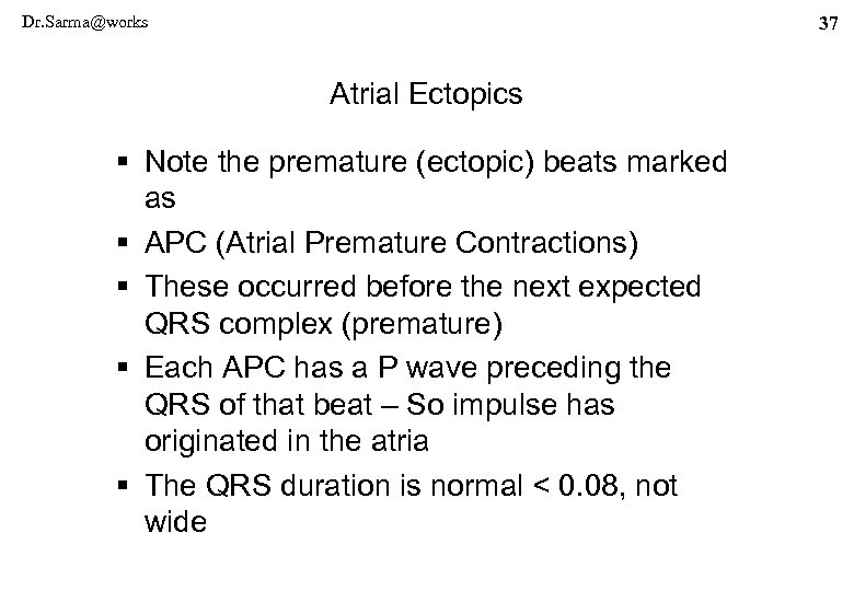 Dr. Sarma@works 37 Atrial Ectopics § Note the premature (ectopic) beats marked as §