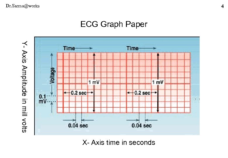 Dr. Sarma@works 4 ECG Graph Paper Y- Axis Amplitude in mill volts X- Axis