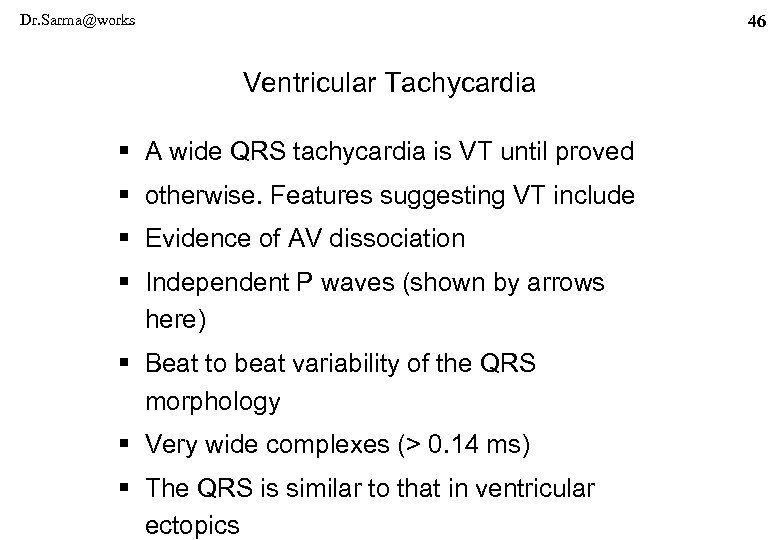 Dr. Sarma@works 46 Ventricular Tachycardia § A wide QRS tachycardia is VT until proved