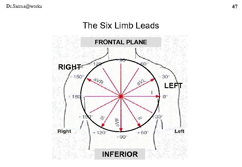 Dr. Sarma@works 47 The Six Limb Leads FRONTAL PLANE RIGHT LEFT INFERIOR 