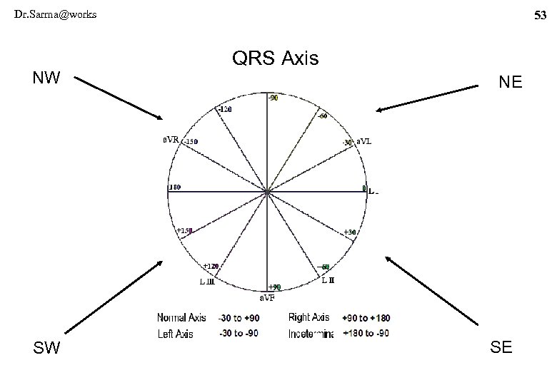 Dr. Sarma@works NW SW 53 QRS Axis NE SE 