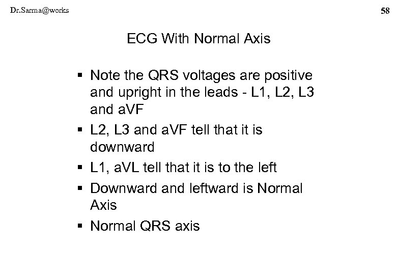 Dr. Sarma@works 58 ECG With Normal Axis § Note the QRS voltages are positive