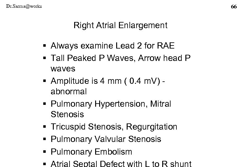 Dr. Sarma@works 66 Right Atrial Enlargement § Always examine Lead 2 for RAE §
