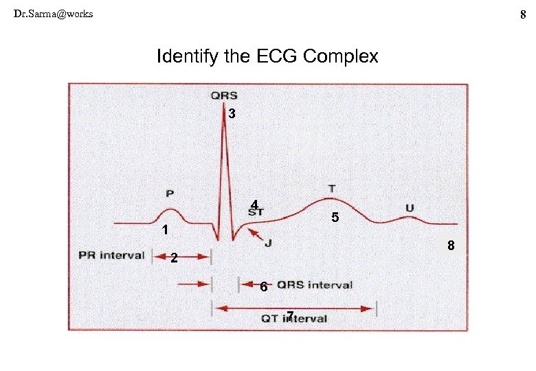 Dr. Sarma@works 8 Identify the ECG Complex 3 4 5 1 8 2 6
