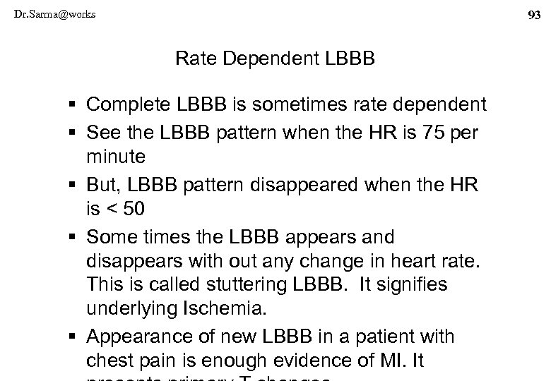 Dr. Sarma@works 93 Rate Dependent LBBB § Complete LBBB is sometimes rate dependent §