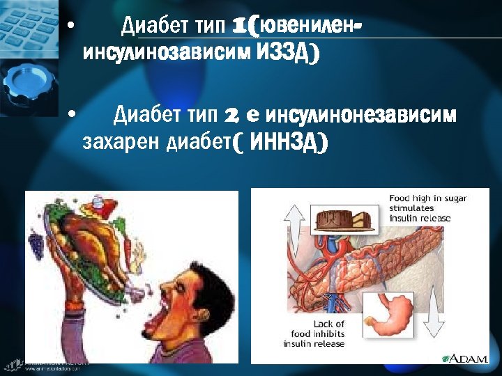  • Диабет тип 1(ювенилен- инсулинозависим ИЗЗД) • Диабет тип 2 e инсулинонезависим захарен