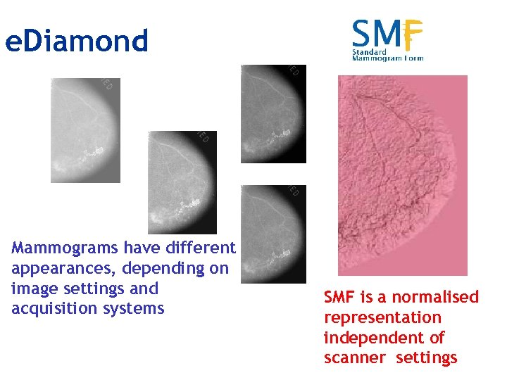 e. Diamond Mammograms have different appearances, depending on image settings and acquisition systems SMF