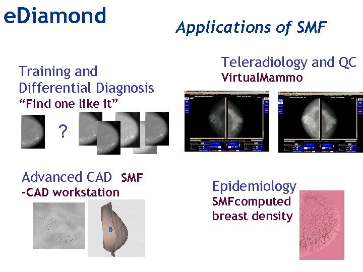 e. Diamond Training and Differential Diagnosis Applications of SMF Teleradiology and QC Virtual. Mammo