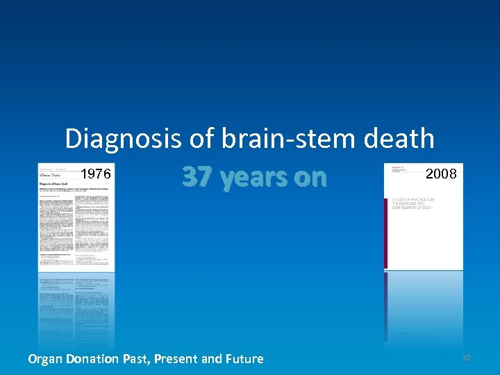 Diagnosis of brain-stem death 1976 2008 37 years on Organ Donation Past, Present and