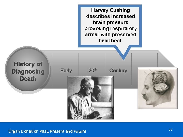 Harvey Cushing describes increased brain pressure provoking respiratory arrest with preserved heartbeat. History of