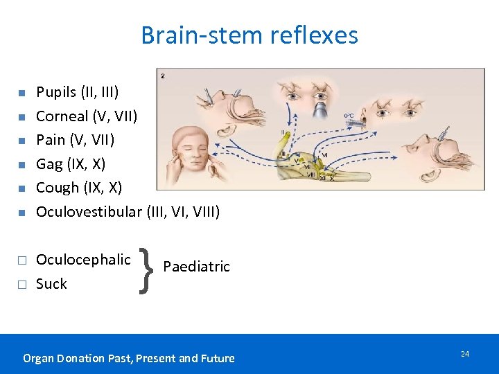 Brain-stem reflexes n n n Pupils (II, III) Corneal (V, VII) Pain (V, VII)