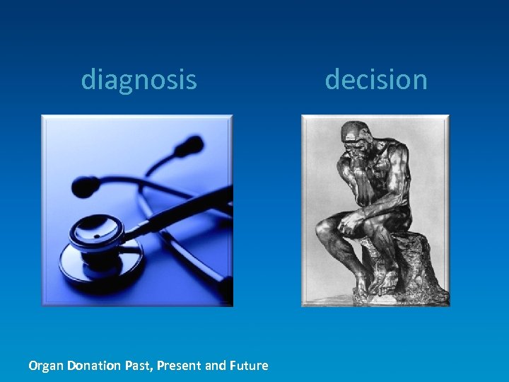 diagnosis decision Organ Donation Past, Present and Future 