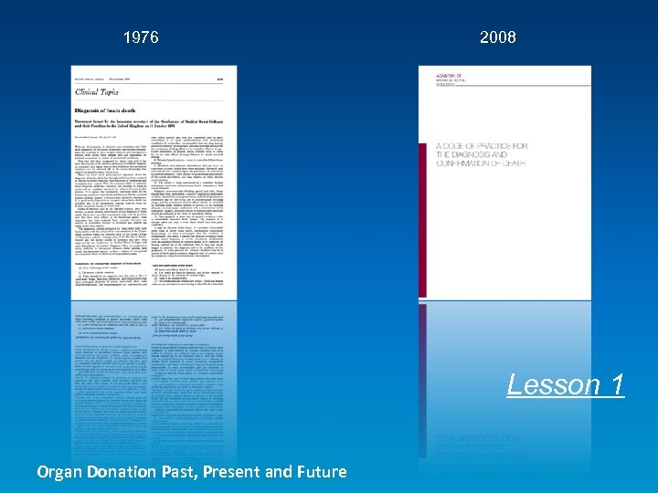 1976 2008 Lesson 1 Organ Donation Past, Present and Future 