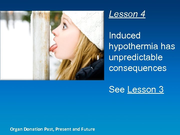 Lesson 4 Induced hypothermia has unpredictable consequences See Lesson 3 Organ Donation Past, Present