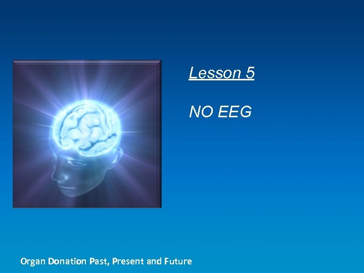 Lesson 5 NO EEG Organ Donation Past, Present and Future 