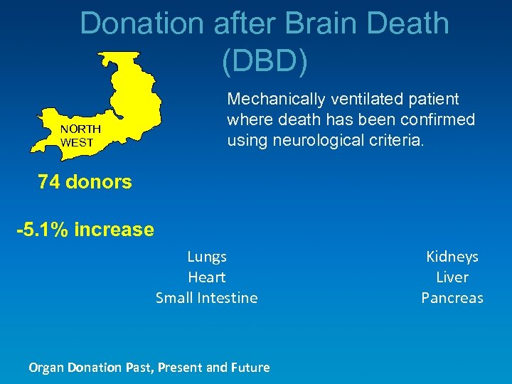 Donation after Brain Death (DBD) NORTH WEST Mechanically ventilated patient where death has been