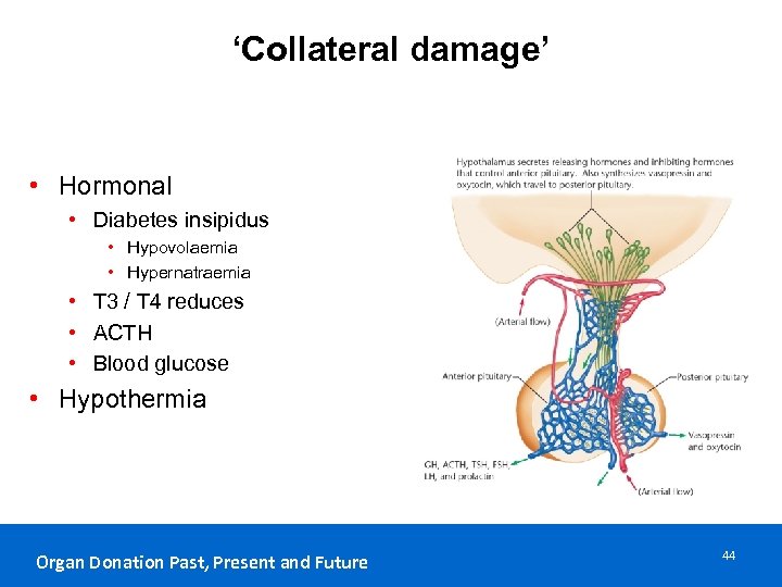 ‘Collateral damage’ • Hormonal • Diabetes insipidus • Hypovolaemia • Hypernatraemia • T 3