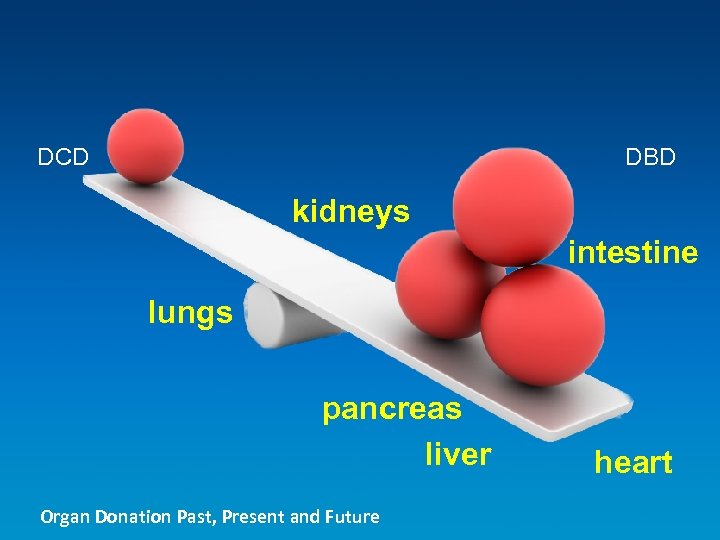 DCD DBD kidneys intestine lungs pancreas liver Organ Donation Past, Present and Future heart