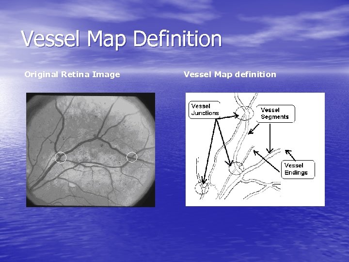 Vessel Map Definition Original Retina Image Vessel Map definition 