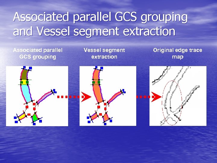 Associated parallel GCS grouping and Vessel segment extraction Associated parallel GCS grouping Vessel segment