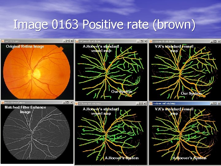 Image 0163 Positive rate (brown) Original Retina Image A. Hoover’s standard vessel map Our
