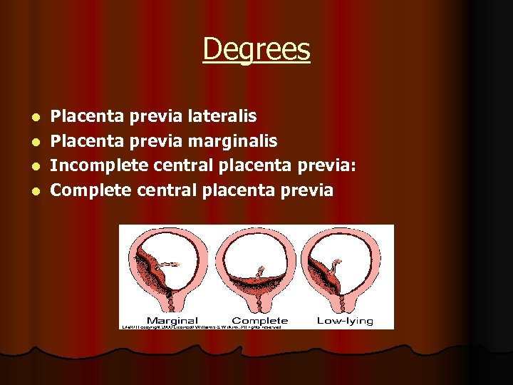 Degrees Placenta previa lateralis l Placenta previa marginalis l Incomplete central placenta previa: l