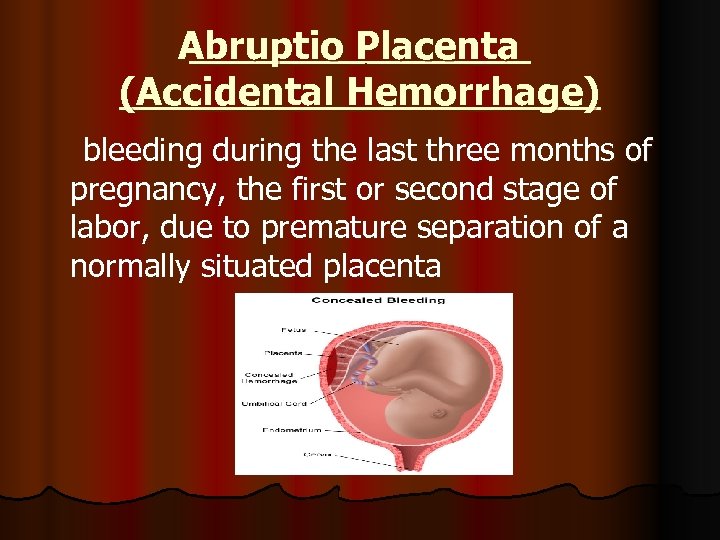 Abruptio Placenta (Accidental Hemorrhage) bleeding during the last three months of pregnancy, the first