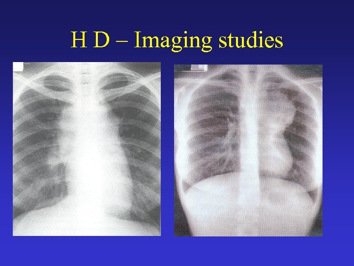 H D – Imaging studies 