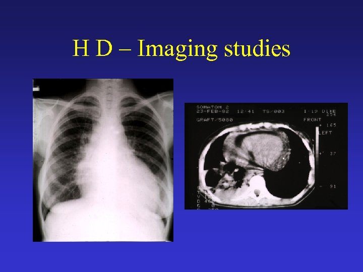 H D – Imaging studies 