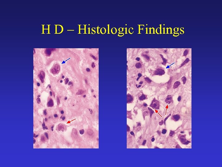 H D – Histologic Findings 