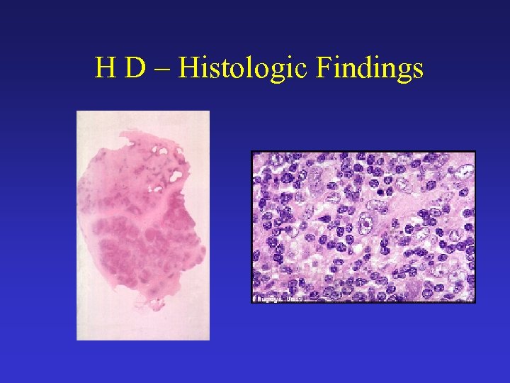 H D – Histologic Findings 