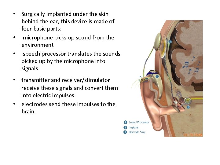  • Surgically implanted under the skin behind the ear, this device is made